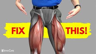 Image result for What to Do When Your Legs Hurt