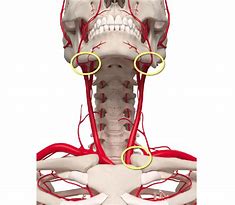 Image result for Carotid Sinus in the Neck