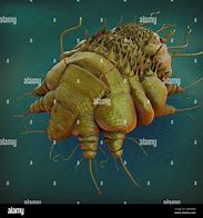Image result for A Beautiful Picture of Scabies Bug