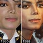 Image result for Michael Jackson Plastic Surgery Gone Wrong