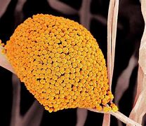 Image result for Fungus Cell Structure