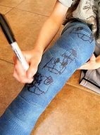 Image result for Leg Cast Drawing