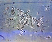 Image result for Candida Albicans Fungus