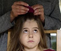 Image result for What Does Lice Look Like