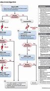 Image result for Recover CPR Als ECG Algorithm