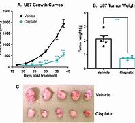 Image result for Pituitary Tumor Size