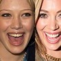Image result for Pretty People with Bad Teeth