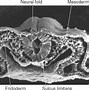 Image result for Vesicles of Neural Tube