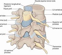 Image result for Lumbar Spine Facet