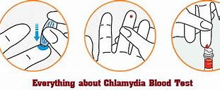 Image result for Chlamydia Blood Screen Test