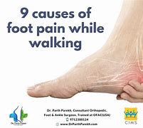 Image result for Foot Sole Pain