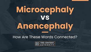 Image result for Types of Anencephaly