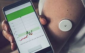 Image result for Diabetes Wearable Technology