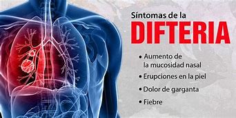 Image result for difteria