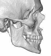 Image result for Jawbone Shape