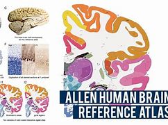 Image result for Whole Brain Atlas