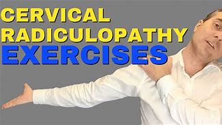 Image result for Exercises for Cervical Radiculopathy