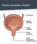 Image result for cewka_moczowa