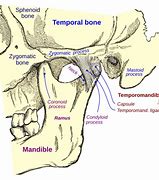 Image result for Lower Jaw Pain Sinus