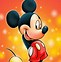 Image result for Anencephaly Mickey Mouse