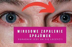 Image result for co_to_znaczy_zapalenie_gardła