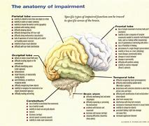 Image result for The Anatomy of Impairment Brain Chart