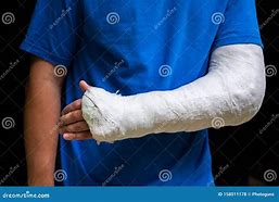 Image result for Gips Arm