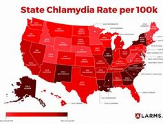Image result for Chlamydia Outbreak