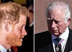 Image result for Prince Harry Hair Before and After