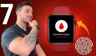 Image result for Apple Watch Burns Wrist