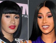 Image result for Cardi B Before Surgery