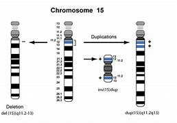 Image result for Chromosome 15 Disorder