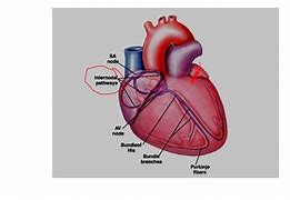 Image result for cardioframa