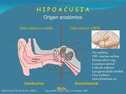 Image result for acucia