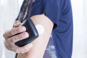 Image result for Implanted Blood Glucose Monitor