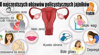 Image result for co_to_za_zespół_pco