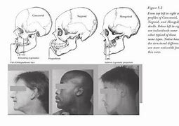 Image result for Skull Shape and Race