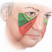 Image result for Face Cheek Anatomy