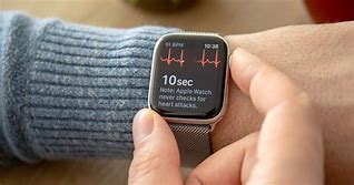 Image result for Applewatch EKG Smartwatch