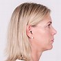 Image result for Comparison of Hearing Aids Types