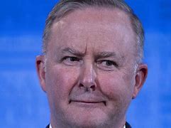 Image result for albo