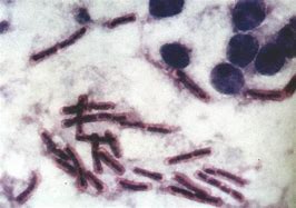 炭疽病毒 的图像结果