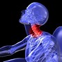 Image result for Lower Back Pain After Car Accident