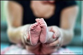 Image result for Baby Faith Anencephaly