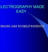 Image result for Electrograph