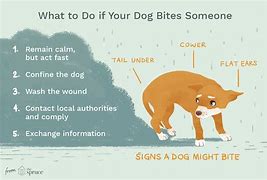 Image result for Dog Bite Human