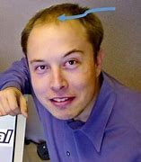 Image result for Elon Musk Bald
