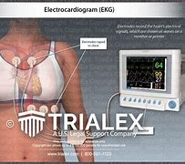 Image result for EKG