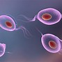 Image result for Trichomoniasis