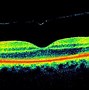 Image result for Monitor Virtual De Retina